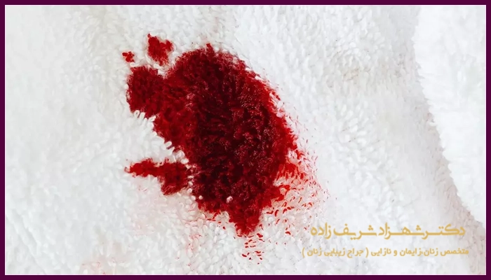 خون یائسگی چه رنگی است