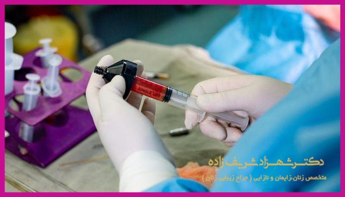 دلایل تزریق چربی به واژن