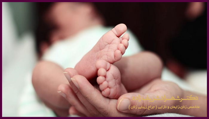 علت تمایل مادران به انجام زایمان به روش سزارین