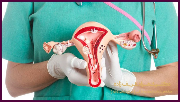 عمل برداشتن رحم در چه مواقعی ضرورت پیدا میکند؟