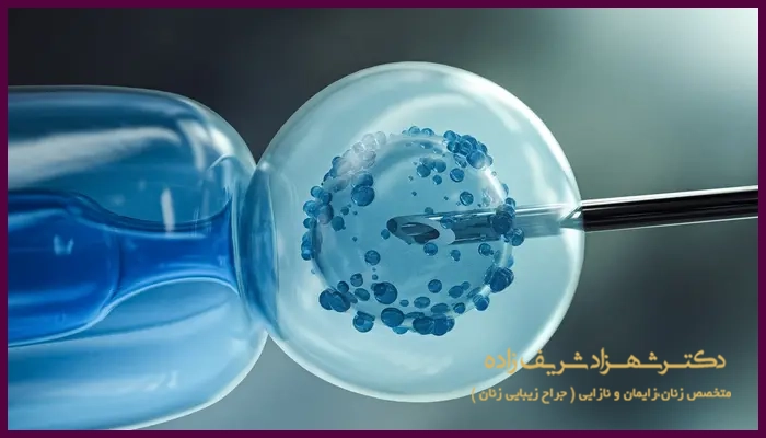 درمان ناباروری با IVF برای چه کسانی مناسب است؟